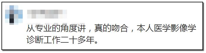 电子烟引起的新冠肺炎？传统烟草表示不想背锅